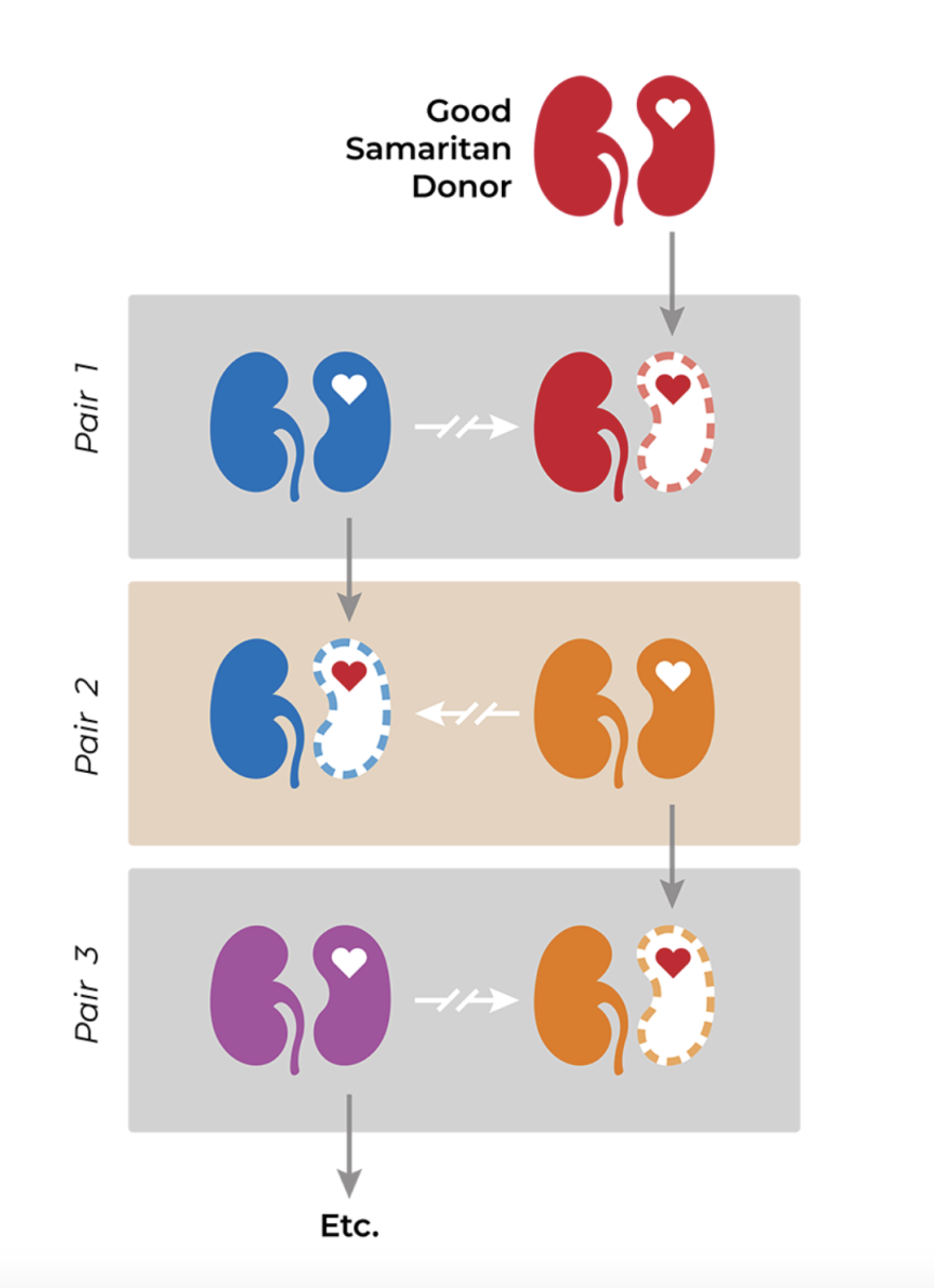 a drawing of kidneys showing how a donation chain works