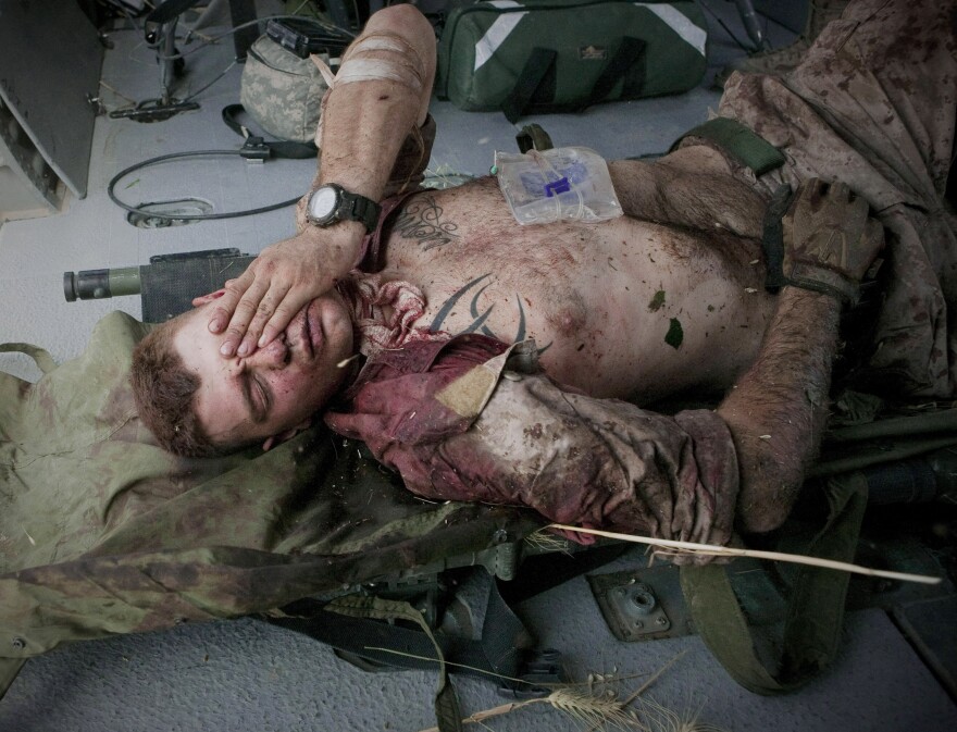 U.S. Marine Cpl. Burness Britt reacts after being lifted onto a U.S. Army medevac helicopter, June 4, 2011. Britt was wounded in Afghanistan's Helmand province. Niedringhaus held Britt's hand in the helicopter and noticed a piece of wheat stuck to his shirt. She picked it up and saved it, then gave it to him months later when she visited him in the hospital. He told her it was his lucky charm.