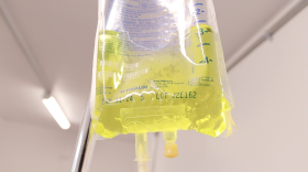 An IV bag hangs with yellow fluid